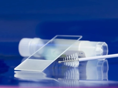 Beaune - Le test de dépistage du papillomavirus (HPV) désormais disponible au laboratoire hospitalier