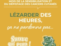 Juin jaune 2026 - Prévention, innovation, expertise : le CHU Dijon Bourgogne mobilisé contre les cancers cutanés