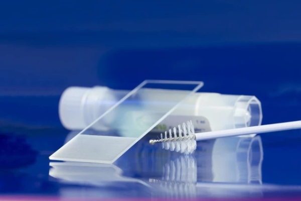 Beaune - Le test de dépistage du papillomavirus (HPV) désormais disponible au laboratoire hospitalier