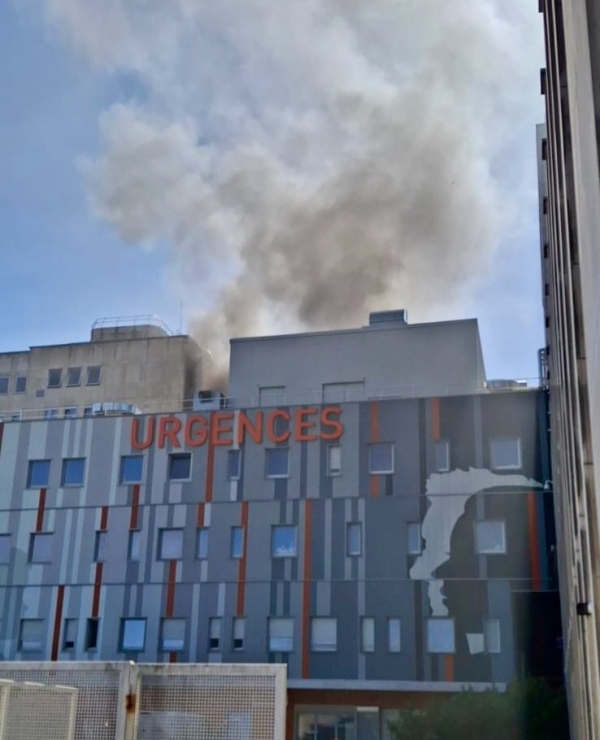 Départ de feu maîtrisé au CHU de Dijon