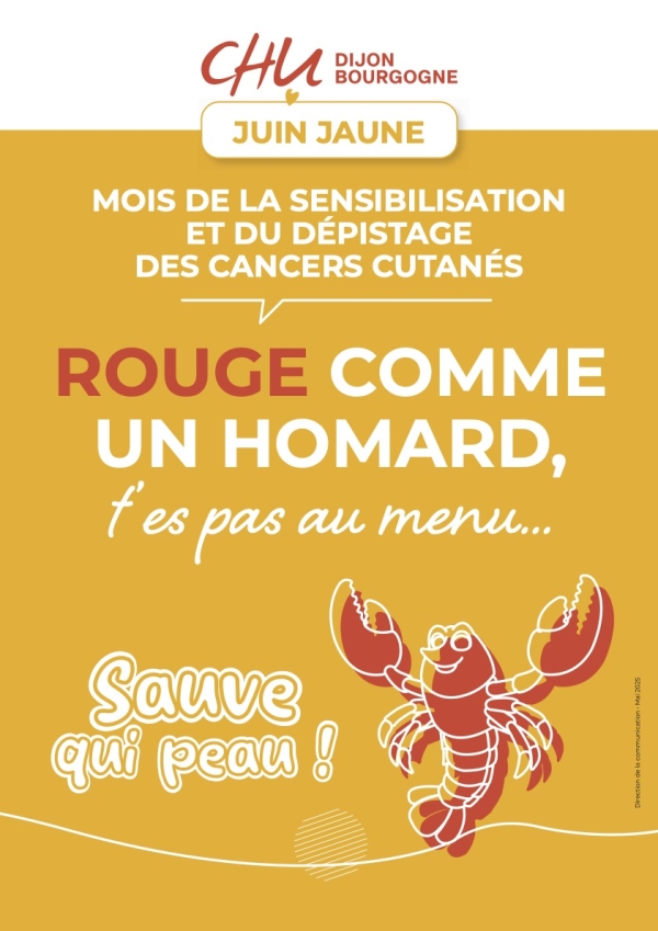 Juin Jaune : le CHU Dijon Bourgogne se mobilise pour la prévention contre les cancers de la peau