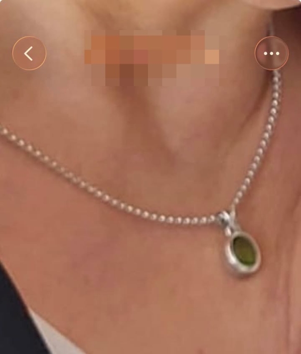 Beaune – Une chaîne perdue, appel à la solidarité